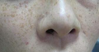 �����ȸ�߻᲻����