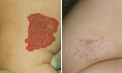 ̥�Ǿ�����Ļ��Ŵ���