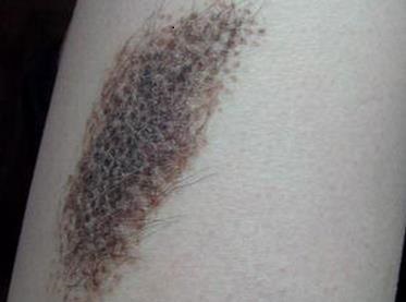 ��ɫ̥����ôȥ��̥��