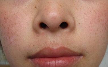 ���ȸ�ߺõķ�����ʲô