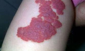 ��̥������ʱҪע��ʲô