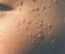 Ԥ����ƽ��ķ�������Щ