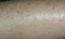 С��Ϊʲô��������۲�