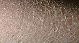 ���۲���Ի��߲���ʲôӰ����