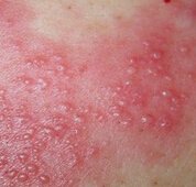 ��״�������ʲôԭ���������