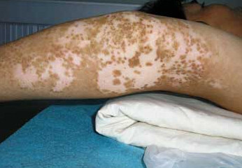 ÖØÇì¿´°×ñ°·çÄĸöÒ½ÔººÃ