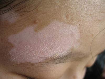 ÖØÇì°×ñ°·çÄļÒÒ½ÔººÃ