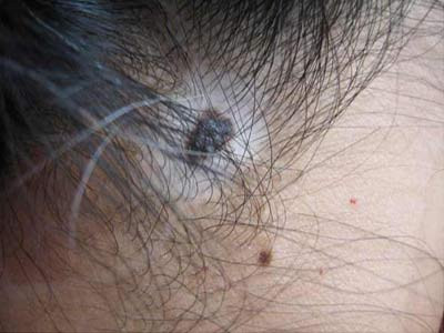 ���������ư���ҽԺ