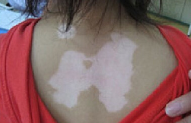 �����ƽ��ר��ҽԺ