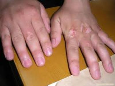 ����ʲôҽԺ���ѷ���