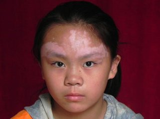 �����ĸ�ҽԺ���ƻ�ָ�׺�