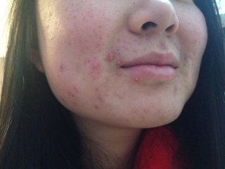 �������ƶ�����Ҫ����Ǯ