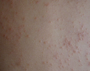 ʪ������ô�����