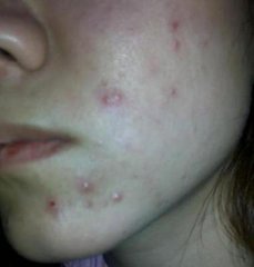 ������������Ҫ��ô����